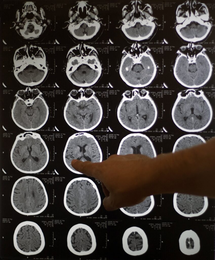 Brain Scans