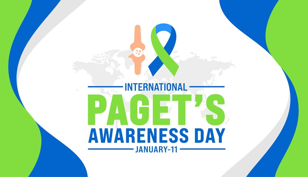 Paget’s Awareness Day - Research and Advancements in Paget’s Disease