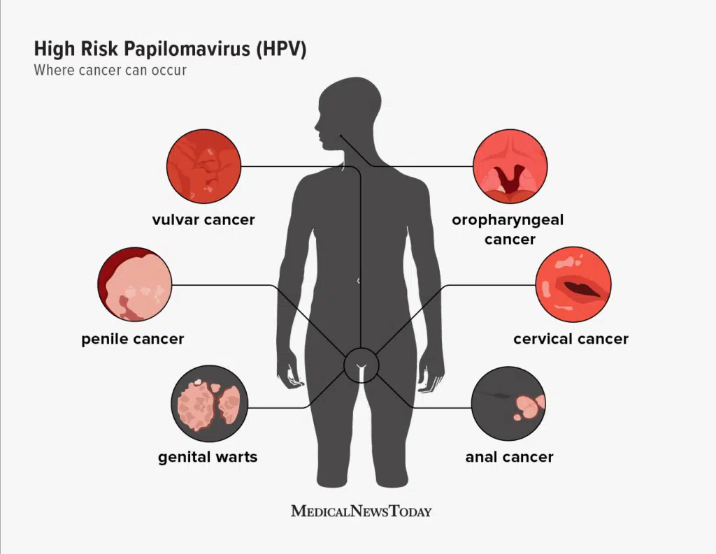 hpv symptoms