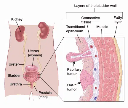 Bladder