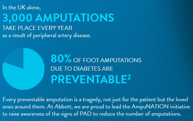 ampunation