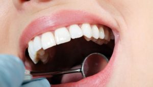 Clinical Negligence - Dental Treatments
