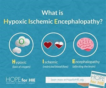 Hypoxic Ischaemic Encephalopathy (HIE) - Williamsons Solicitors
